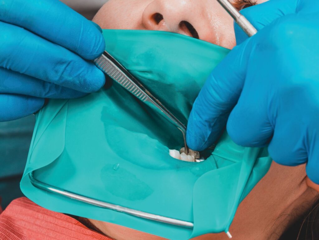 How Can Dentists Master Dental Dam Placement Techniques? How Can Dentists Master Dental Dam Placement Techniques?
